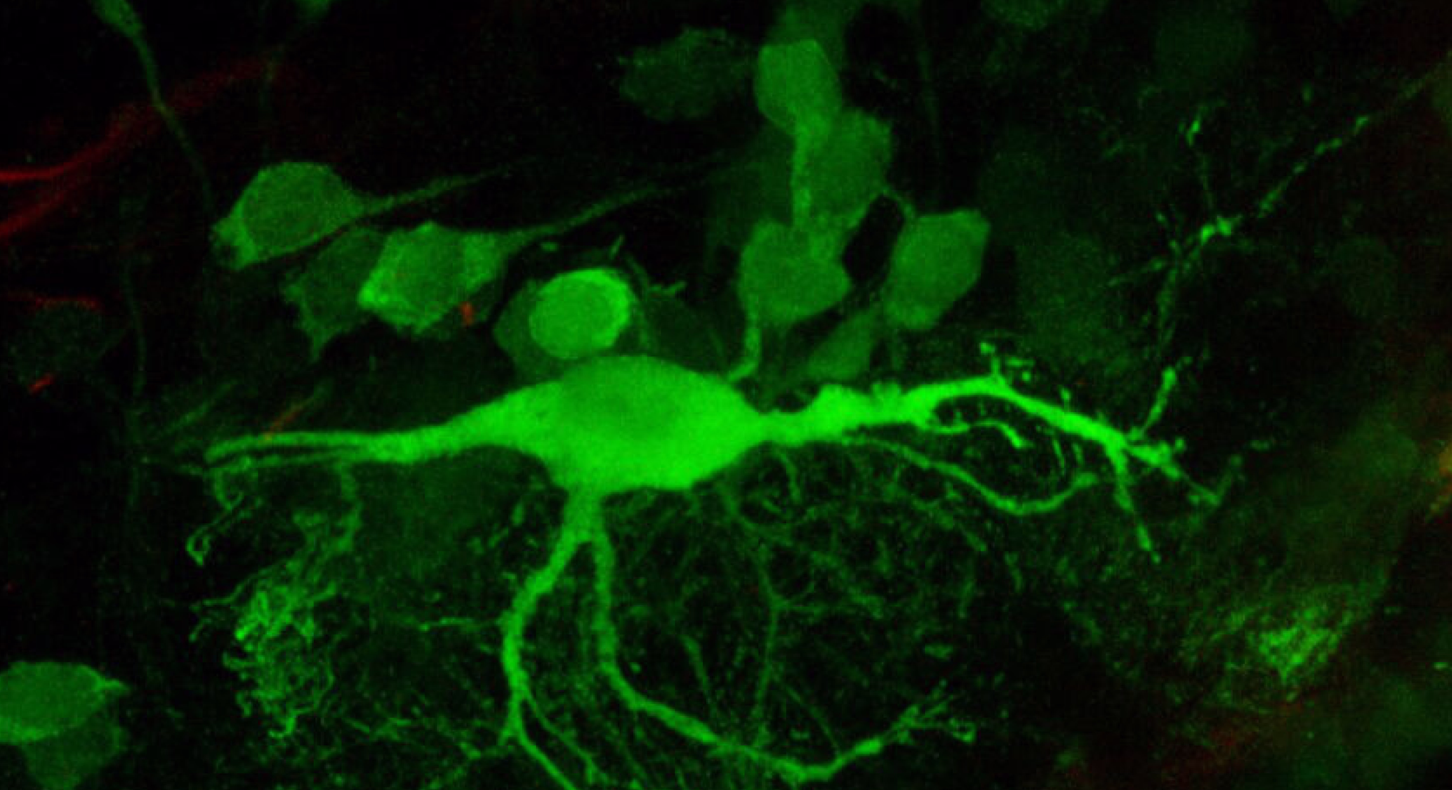 Fluorescent image of a reticulospinal neuron showing neural structure and connectivity in the human brain