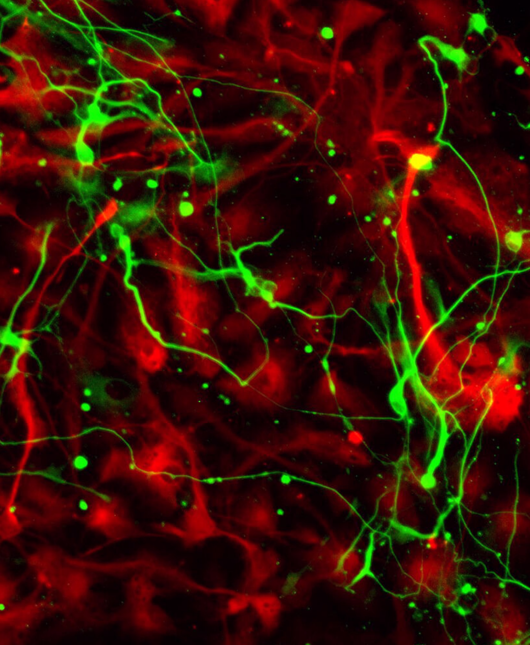 Differentiated neural stem cells forming neural pathways — brain development and neurogenesis visualization