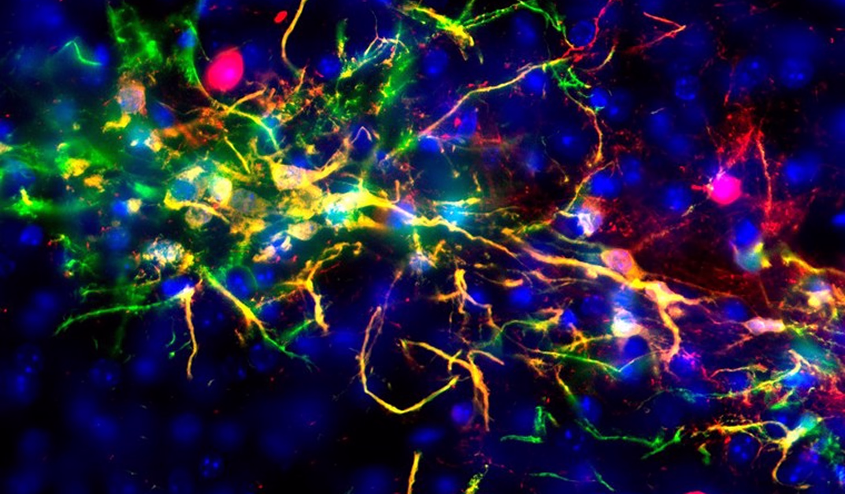 Transplanted neural stem cells differentiating into neurons — neurogenesis and brain regeneration visualized