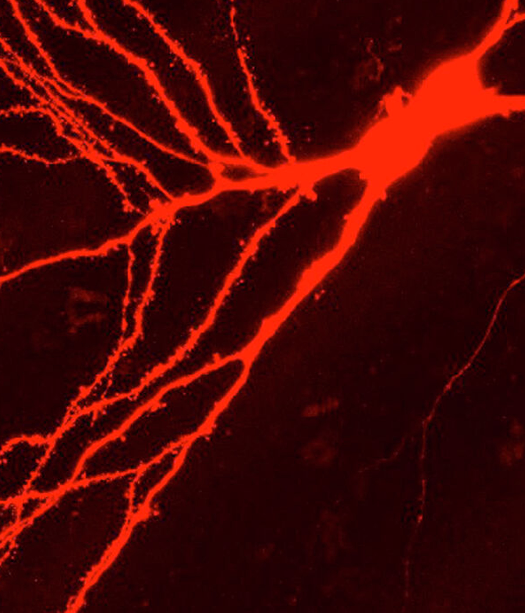Confocal image of neuron dendrites in red — brain synaptic network visualization