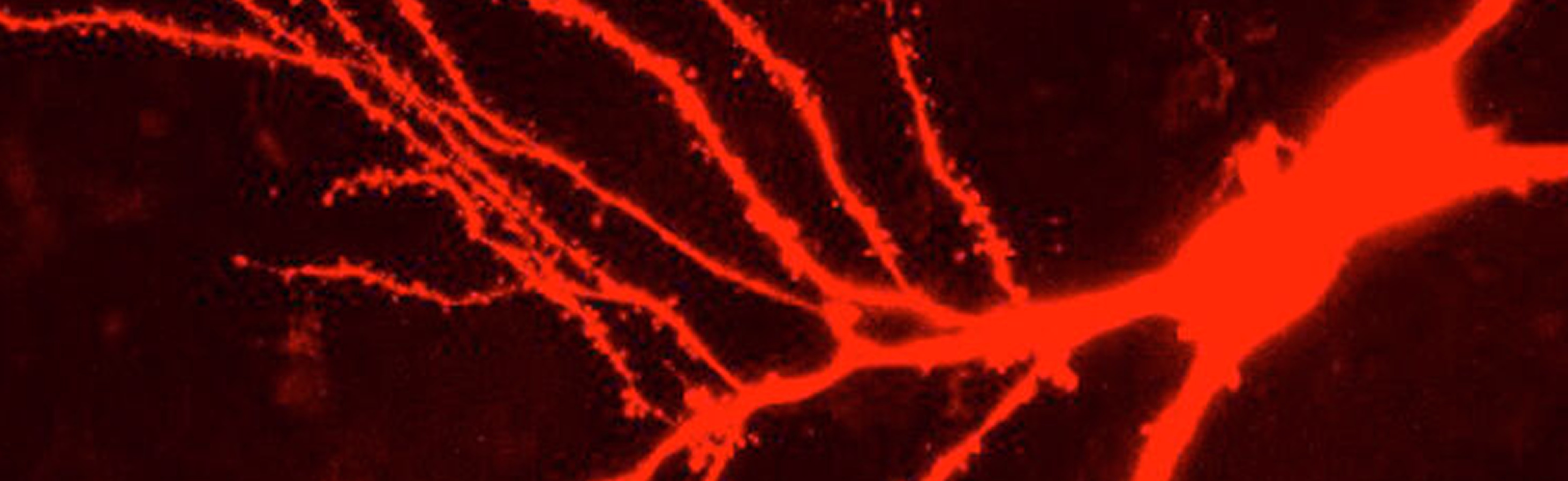 Confocal image of neuron dendrites in red — brain synaptic network visualization