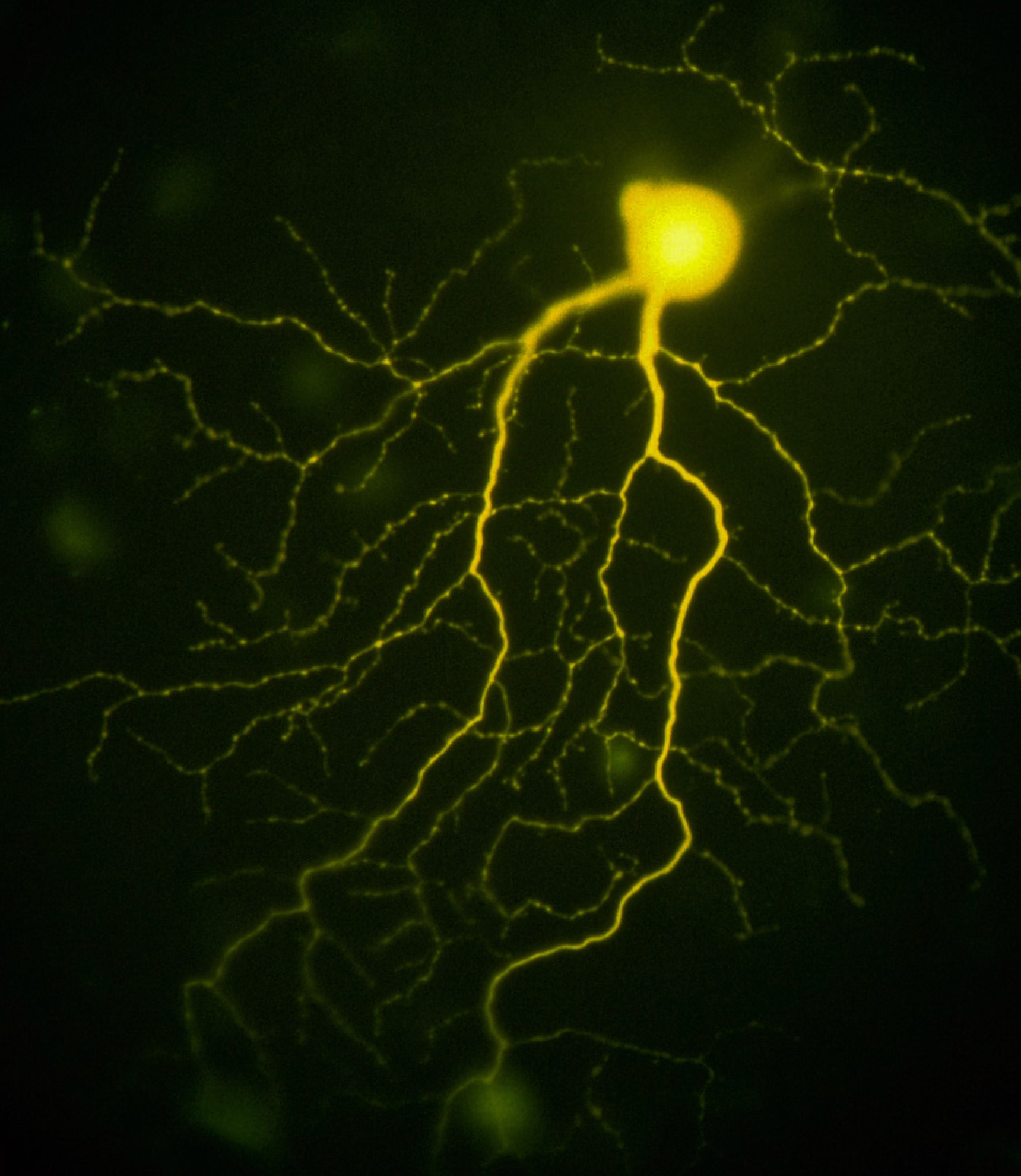Gamma ganglion neuron from retina with branching axon — neural signal transmission visualization