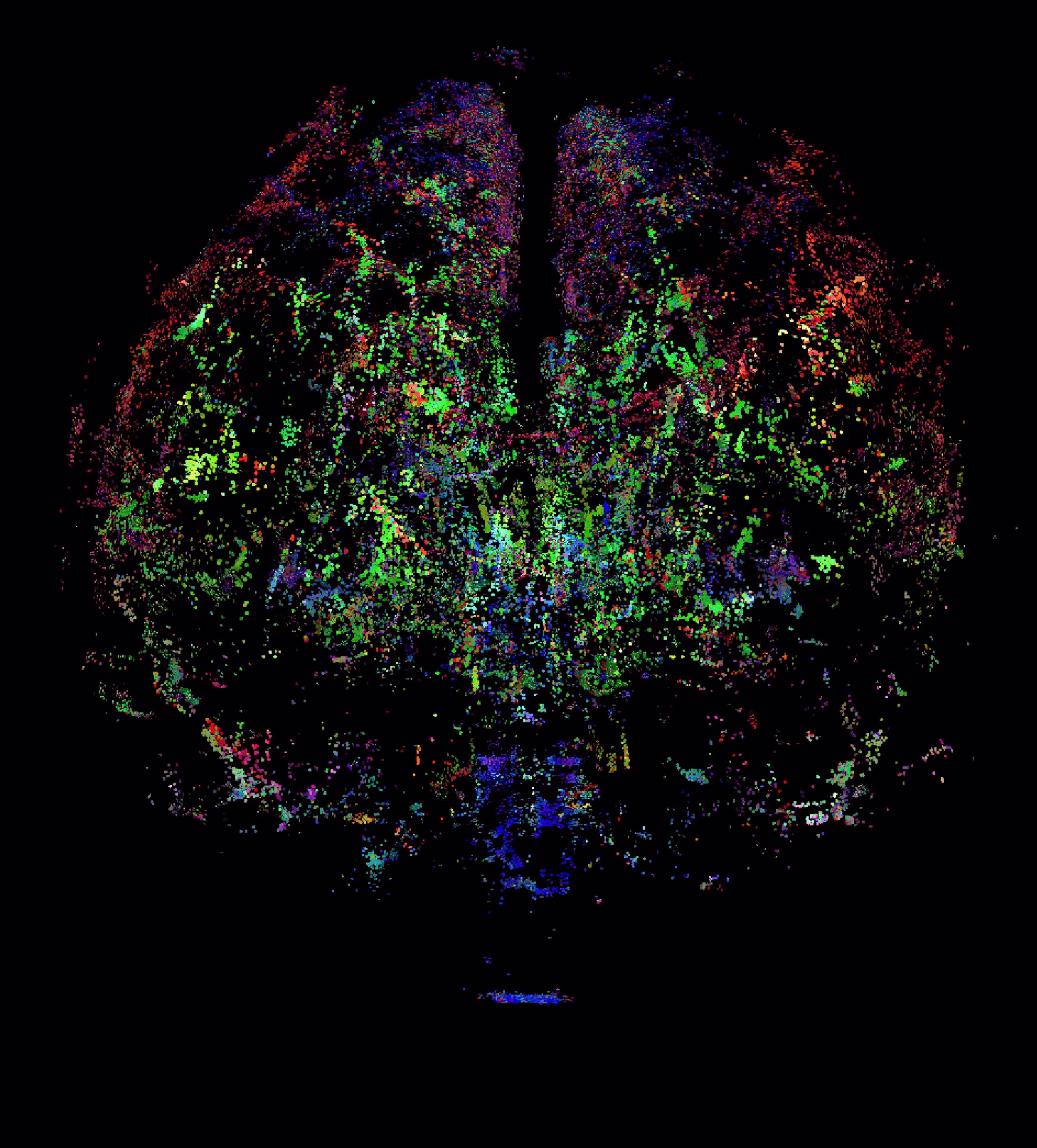 Colorful brain tractography of a healthy adult showing neural pathways and cognitive network structure