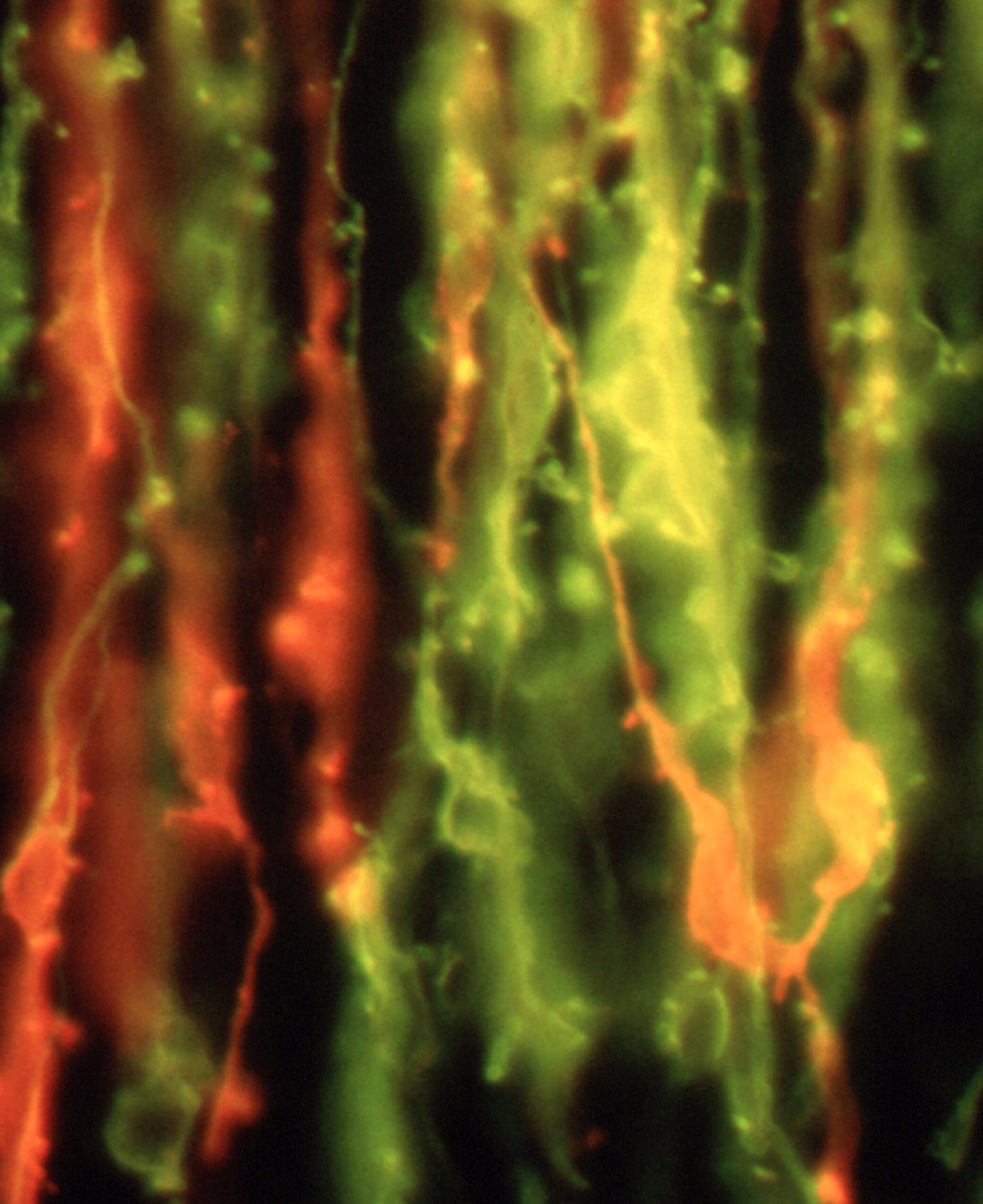 Fluorescent imaging of cranial nerves highlighting neural pathways and nerve fiber structures