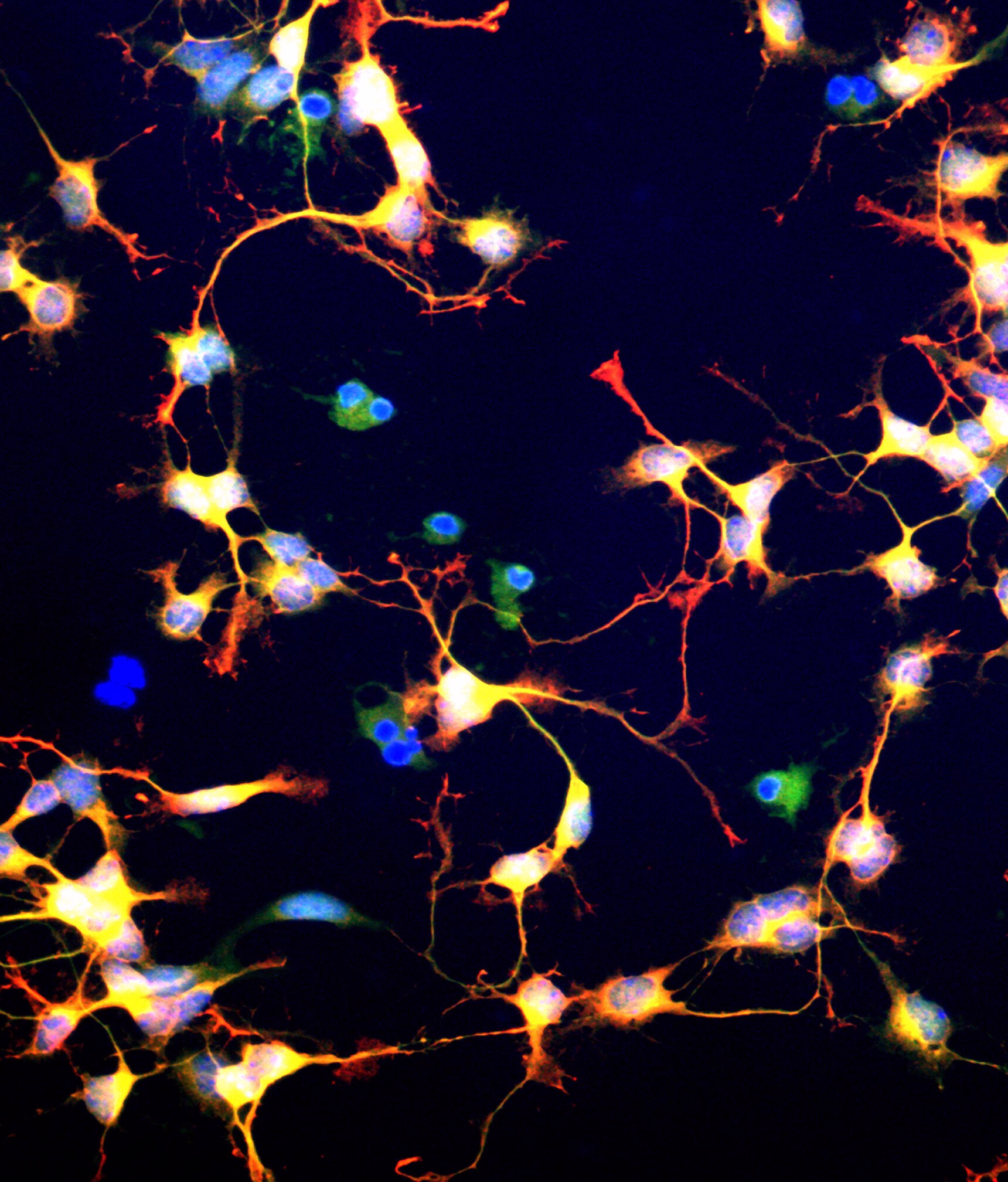 Microscopic image of differentiating neuroblasts with visible neural projections and active cell structures