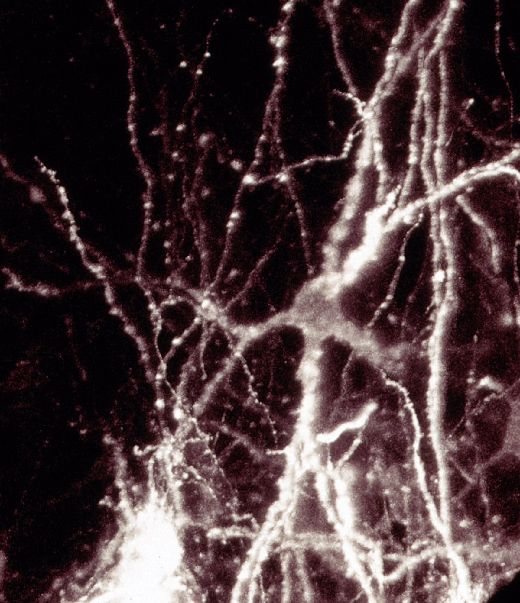 High-resolution confocal image of interneurons in the brain visualized by fluorescence microscopy