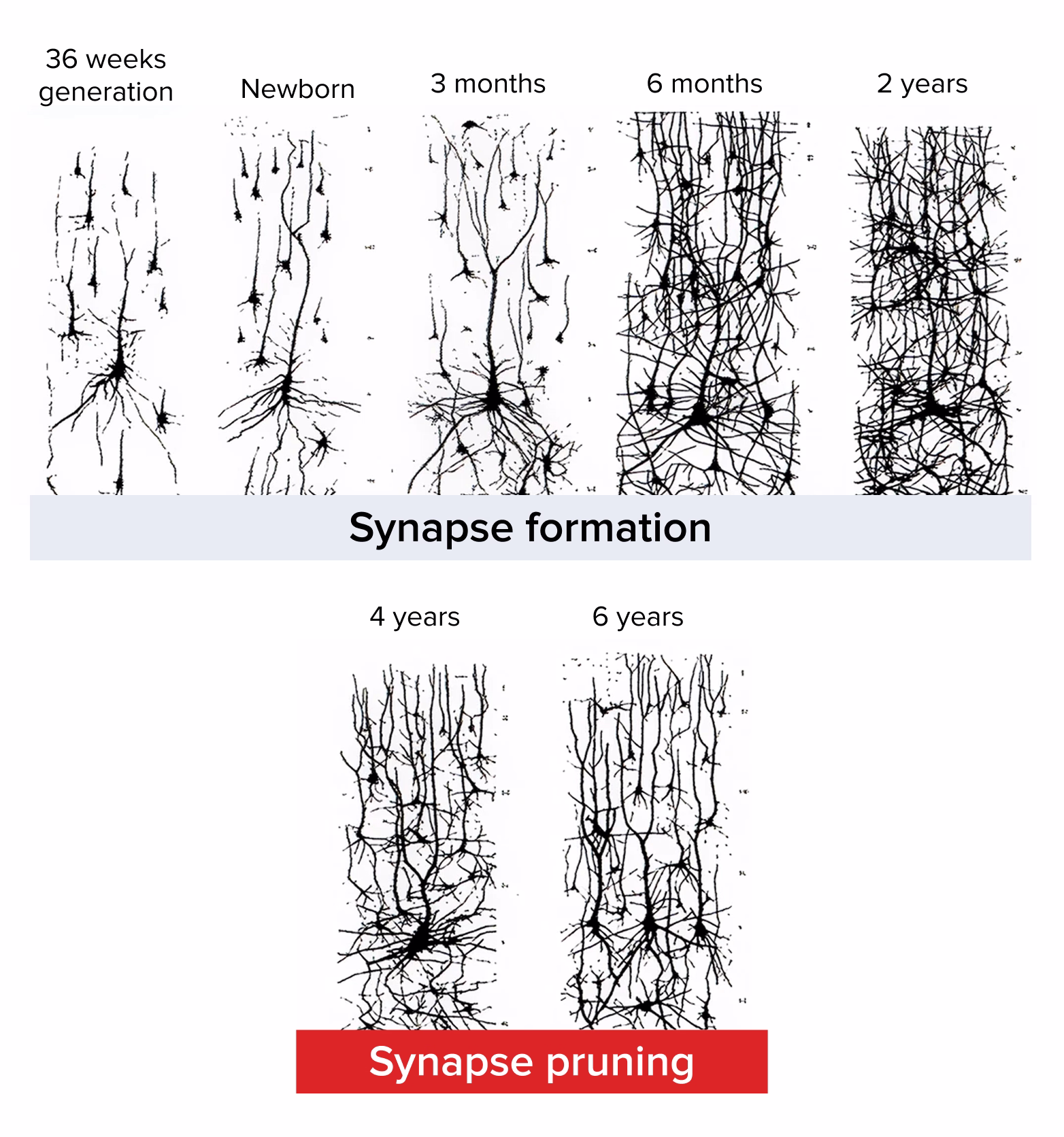 Synapse formation and pruning across child brain development from birth to 6 years